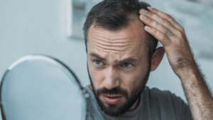 man looking at his balding head with a hand-held mirror