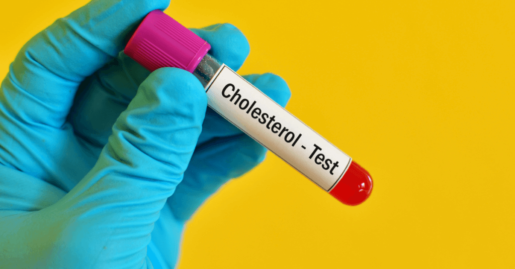 Cholesterol test