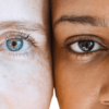 Eye Conditions & Glaucoma
