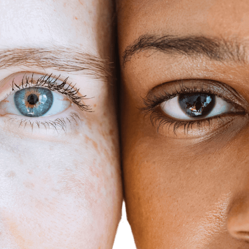 Eye-Conditions-Glaucoma-cat-image