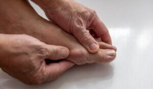 A person with gout pain.