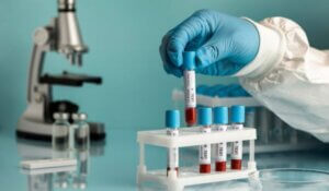 Hand Holding a Blood Samples for blood Test