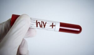 HIV Test, HIV Positive