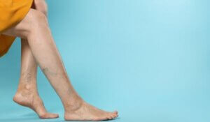 About deep vein thrombosis