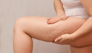 Person Squeezing Legs on Beige Background