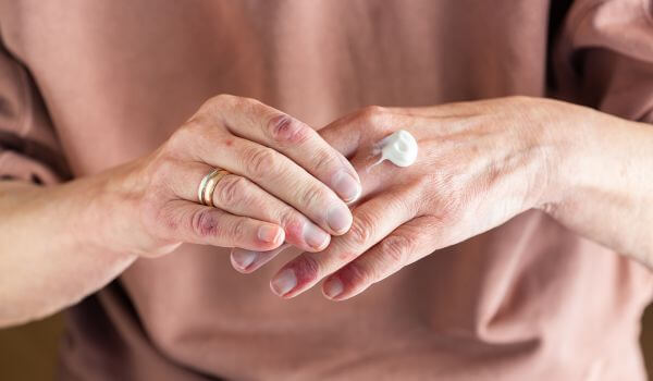What are topical corticosteroids used for