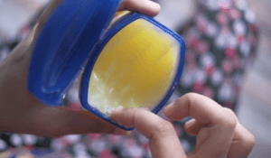 Accutane is well known for drying out your skin (1)