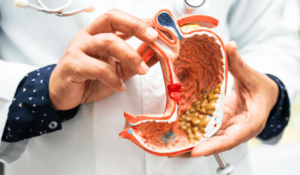 What are the risk factors for chronic kidney disease