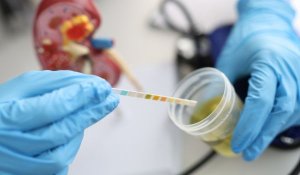 Diagnosing cystitis with urine tests