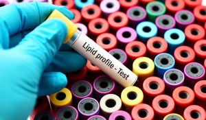 How to stop the liver from producing cholesterol