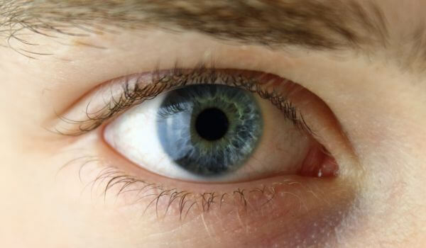 How Can I Prevent Seasonal Allergic Conjunctivitis