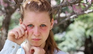 Is allergic conjunctivitis contagious