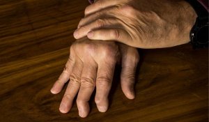 Skyrizi vs. Bimzelx for psoriatic arthritis